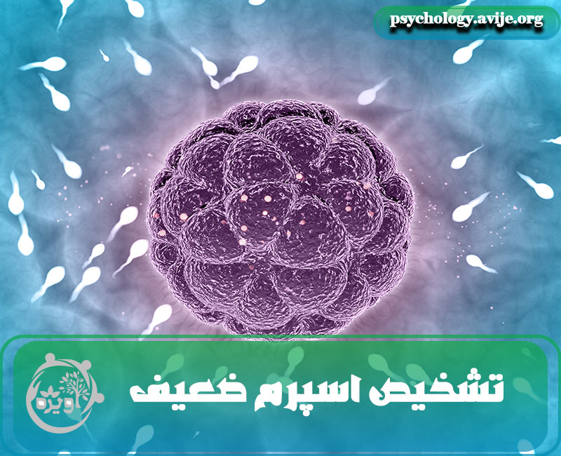 تشخیص اسپرم سالم و ضعیف